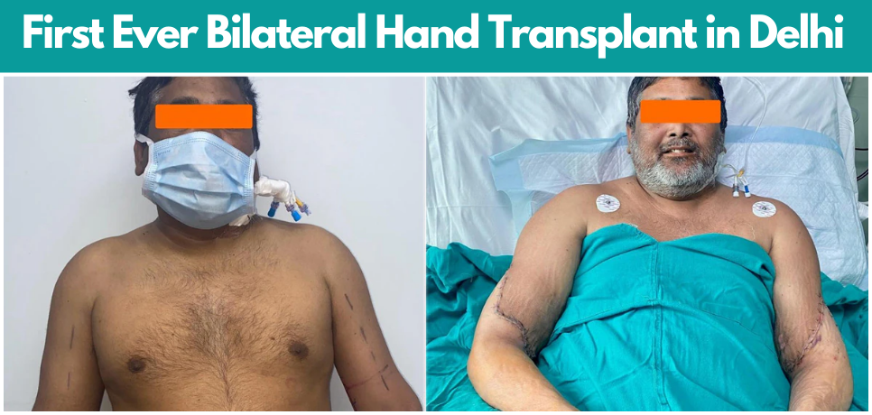 Painter to Hold Brushes Again After a 12-Hour Long Surgery: Delhi's First Ever Bilateral Hand Transplant