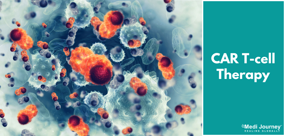 CAR T-Cell Therapy: What it is and how it works