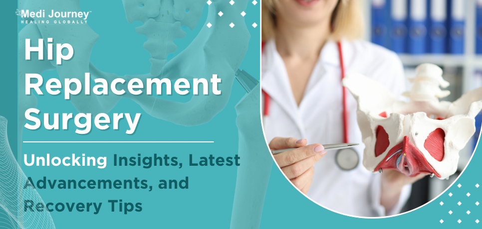 Hip Replacement Surgery: Unlocking Insights, Latest Advancements, and Recovery Tips
